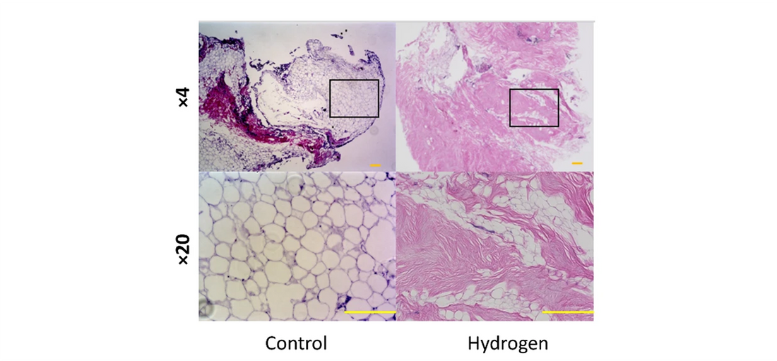 The effect of hydrogen gas on the oxidative stress response in adipose tissue